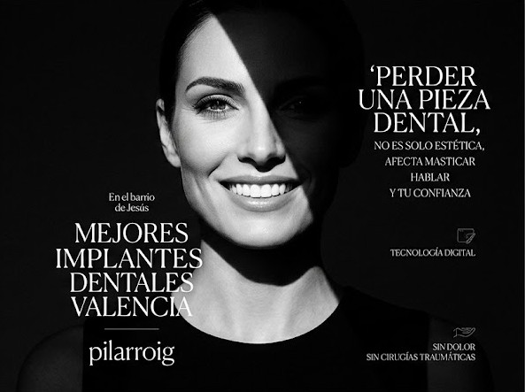 implantes dentales en valencia